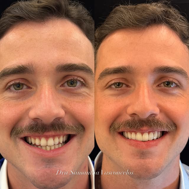 Transformação Facial